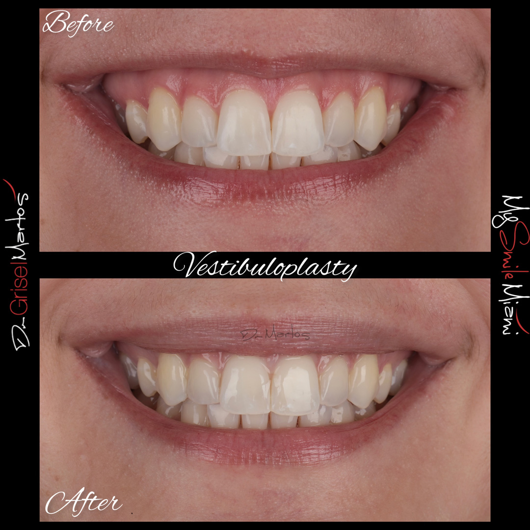 repositioning gallery