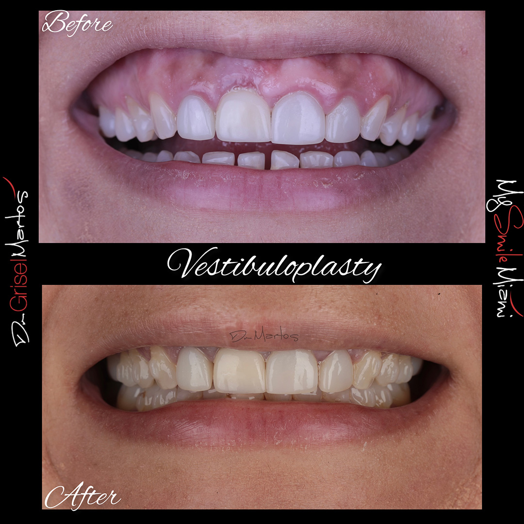 repositioning gallery