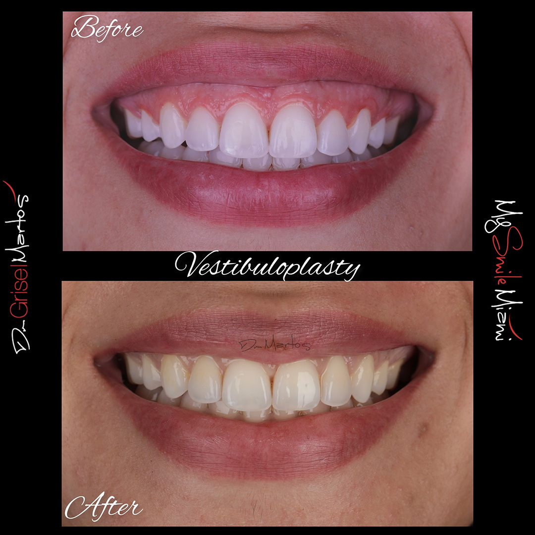 repositioning gallery