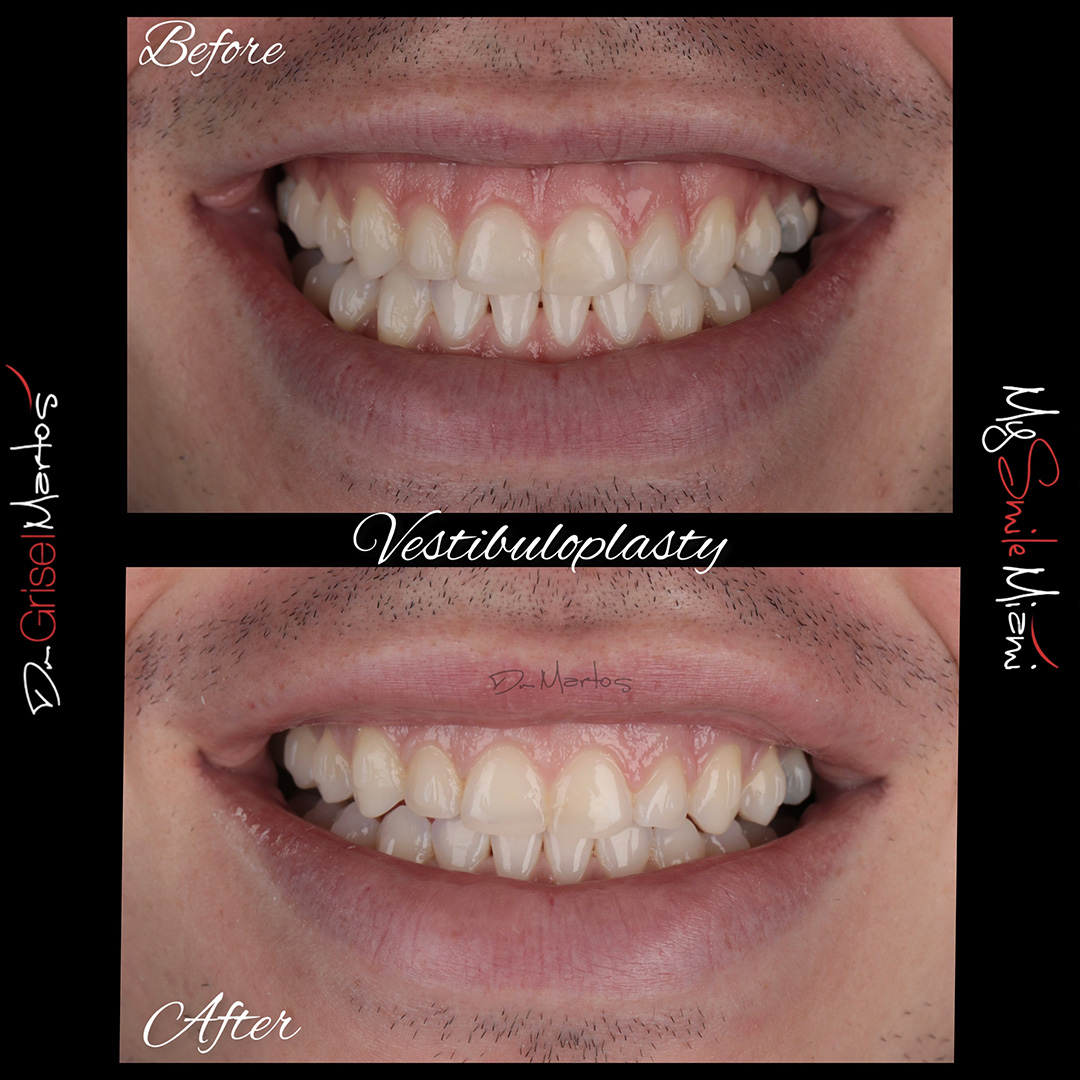 repositioning gallery