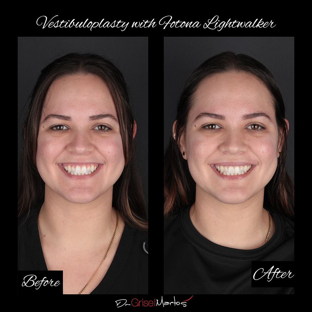 repositioning gallery