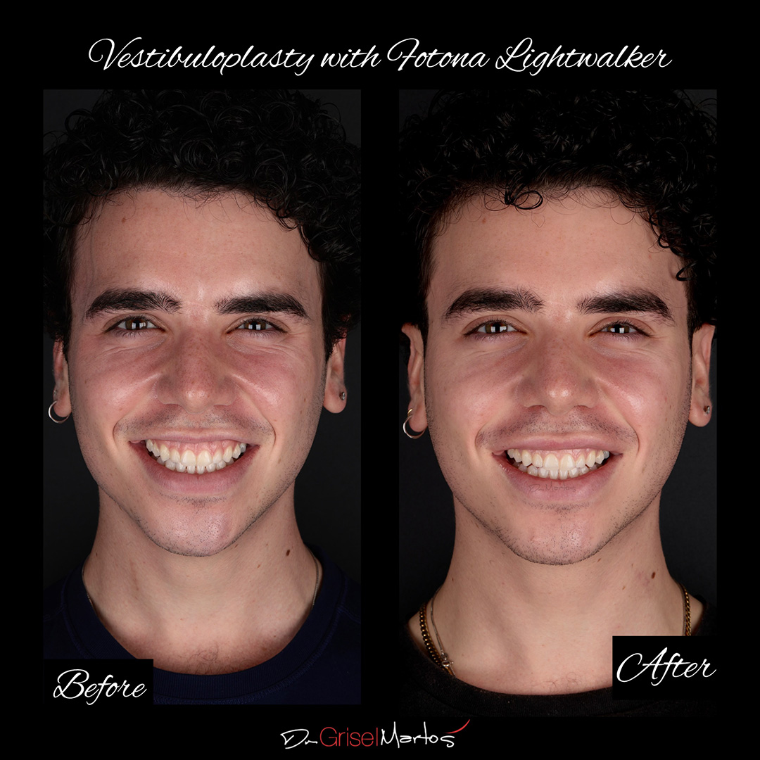 repositioning gallery