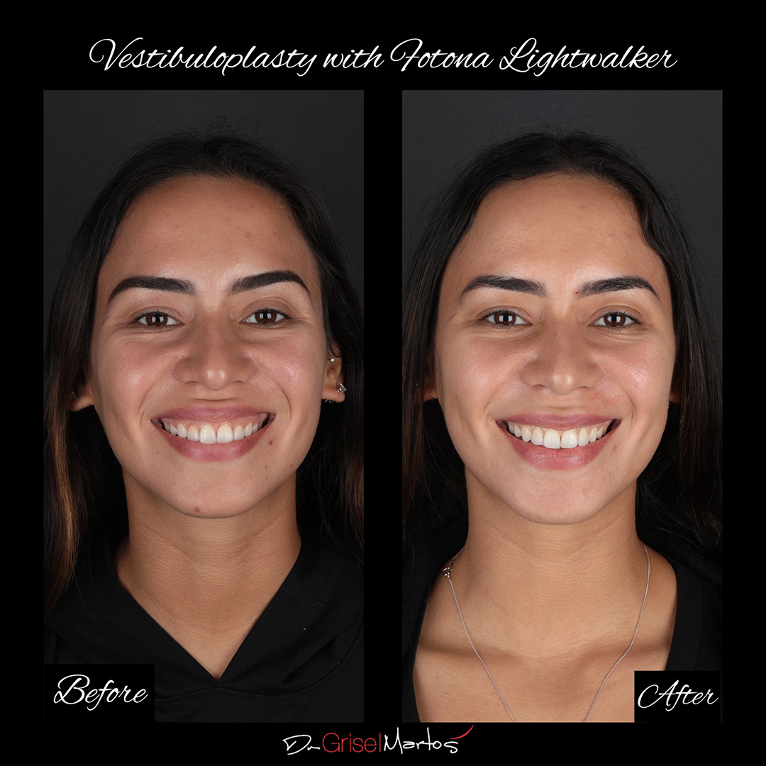 repositioning gallery