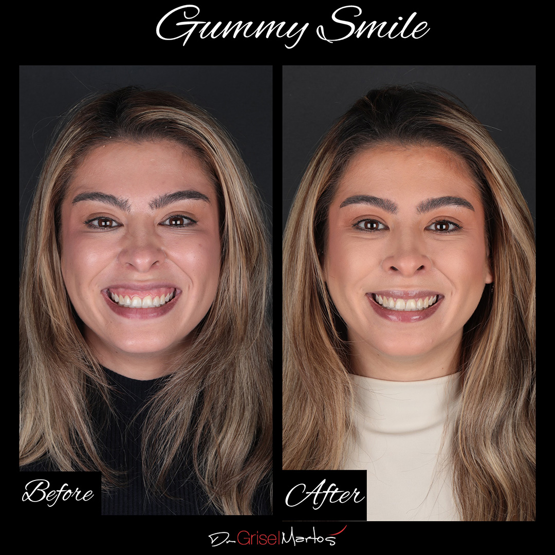 repositioning gallery